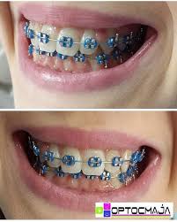 Available file formats are pdf, adobe swatch (ase) and photoshop swatch (aco). Color Wheel Sky Blue Light Blue Braces Novocom Top