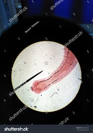 Image result for Beef Tapeworm