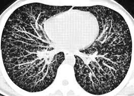 American Journal of Roentgenology