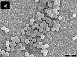 Learn mrsa infection causes, symptoms, treatment, and transmission by mrsa carriers. Sem Micrographs Of Methicillin Resistant Staphylococcus Aureus Mrsa Download Scientific Diagram