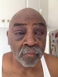 Deaf man paid $175,000 in taxpayer funds to settle claims Oklahoma troopers  used excessive force during traffic stop