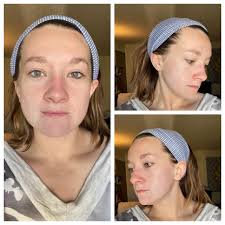 Need help growing new hair? Pomifera is working cut me. I'd love to share  how.