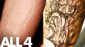 A self harm cover up tattoo is going to look better on a scar that is healed, as opposed to one that is still healing. Covering Self Harm Scars With A Beautiful Tattoo Devoted To Love Tattoo Twists Youtube