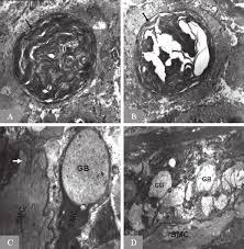The image is available for download in high resolution quality up to 5412x3840. Transmission Electron Microscopy Examination Of Smooth Muscle Cells Download Scientific Diagram