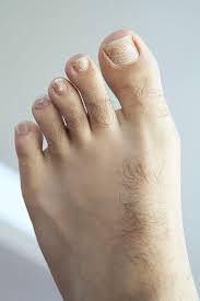 The light energy which is absorbed becomes heat energy and causes the hair to warm up. Do You Have Hair On Your Feet Try Laser Hair Removal