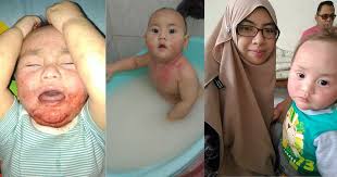 Najis bayi saya berlendir dan berdarah! Anak Sembelit Najis Keras Elakkan Bagi Makan Buah Epal Dan Pisang Pa Ma