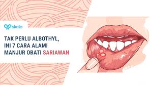 5 cara mengatasi sariawan saat puasa penyebab sariawan di lidah. Tak Perlu Albothyl 7 Cara Alami Manjur Obati Sariawan
