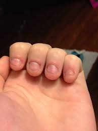 What nail shape is best for short nails? How To Fix And Grow Out Bitten Nails B C Guides