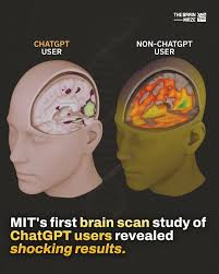 MIT study: AI use may harm brain function and creativity