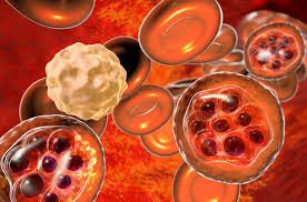 Image result for Malaria