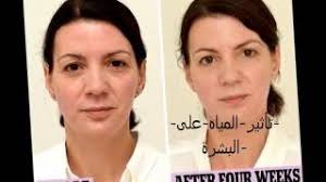 لن تصدق فوائد شرب الماء على البشرة و شعر Youtube