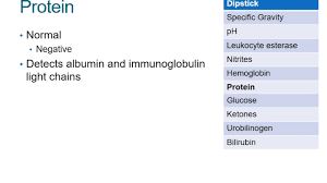 How To Read A Urinalysis Result Youtube