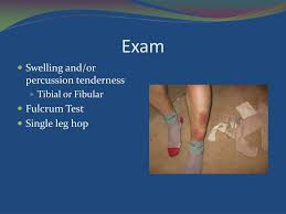 Image result for Fulcrum Test