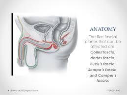 Fournier gangrene is a type of gangrene characterized by the necrosis of cells around the penis. Fournier S Gangrene