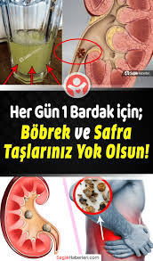 Bobrek Tasi Nasil Duser Evde Bobrek Tasi Icin Bitkisel Cay Dogal Tedavi 2020 Dogal Tedaviler Dogal Saglik Saglik