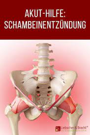 Schambeinentzundung Warum Jeder Sie Bekommen Kann Muskel Und Gelenkschmerzen Schmerzen Hufte Krankengymnastik