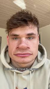 My eyes looks bigger than I expected