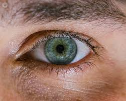 Bullous retinal detachment, coats' disease, exudative detachment localized superior retinal detachment with horseshoe tear and minimal fluid. Retinal Tear What Is It Symptoms Causes Prevention And Treatment Top Doctors