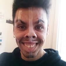 Nuevo look después de la cirugía 😘