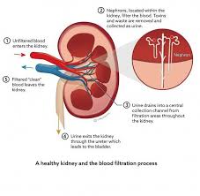 Pin By Janene Des On Wisdom Kidney Failure Treatment Chronic Kidney Disease Kidney