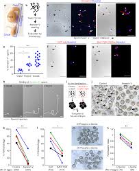 Phosphatidylserine On Viable Sperm And Phagocytic Machinery