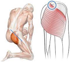This can cause pain in the lower back and/or pain that radiates to the buttocks and down the leg. Massage For Upper Gluteal Pain Gluteus Maximus