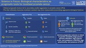 The grade is a way of determining the aggressiveness of the cancer on a scale known as the gleason score. Intermediate Risk Prostate Cancer Disease Heterogeneity Linked To Measurable Biological Features Clinical Oncology