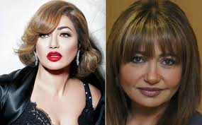 تجميل الانف و تجميل الصدر و زراعة الشعر و تجميل الوجه و تجديد شباب البشرة بالليزر وغيرها. ØµÙˆØ± Ù‡ÙƒØ°Ø§ ØªØ¨Ø¯Ùˆ Ø§Ù„Ù†Ø¬Ù…Ø§Øª Ø¨Ø¯ÙˆÙ† ÙÙˆØªÙˆØ´ÙˆØ¨ Ù‚Ø¨Ù„ ÙˆØ¨Ø¹Ø¯ ØµØ¯Ù‰ Ø§Ù„Ø¥Ø¹Ù„Ø§Ù… 2016 08 18