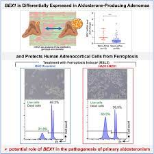 bex1 is differentially expressed in aldosterone producing adenomas and protects human adrenocortical cells from ferroptosis hypertension