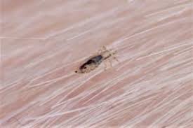 Image result for lice vs nits