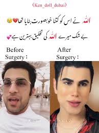 @ken_doll_dubai #fyp #foryou #kendoll #adnanzafar #Allah #surgery #viral