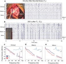 Image result for Methohexital