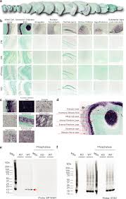 Distribution of phosphorylated alpha-synuclein in non-diseased brain  implicates olfactory bulb mitral cells in synucleinopathy pathogenesis