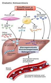 Diabetic ketoacidosis (dka) is a dangerous complication faced by people with diabetes which happens when the body starts running out of insulin. 13 Dka Ideas Diabetes Management Diabetic Ketoacidosis Diabetes