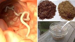 Diese sollten vor jeder mahlzeit gekaut werden. Wie Man Darmparasiten Auf Naturliche Weise Los Wird Youtube