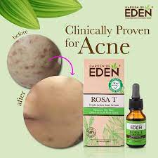 Required fields are marked * Garden Of Eden Rosa T Acne Serum 15ml Alpro Pharmacy