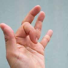 Image result for Trigger Finger