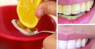 Voici Comment Blanchir Vos Dents A La Maison Oral Health Health Miniature Food