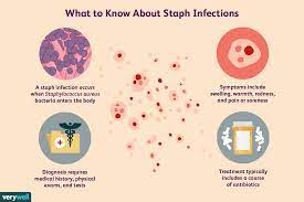 Staph Infection Overview And More