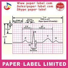 Ecg Paper Electrocardiograph Recording Paper Other 110 140 50mm 30m 63mm 30m Buy Electrocardiograph Recording Paper Ecg Paper Ecg Chart Ecg