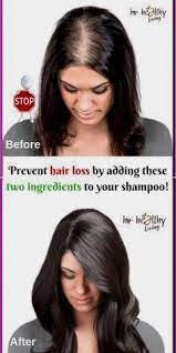 Minoxidil Tablets Hairstyles Long Rice Natural Hair Loss Hair Loss Shampoo Help Hair Loss
