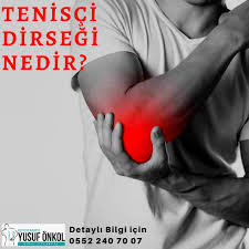 Fizyoterapist Yusuf Onkol Manuel Terapi Teniscidirsegi Teniscidirsegi Tetiknokta Dirsekagrisi Fizyoterapist Terapi Fizyoterapi