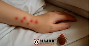 Image result for bedbugs bites