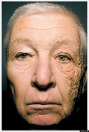 Please enter your username or email address. Bill Mcelligott Delivery Truck Driver Has Severe Sun Damage On One Side Of His Face Photo Huffpost Canada Life