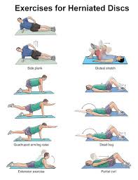 Pin On Herniated Disc