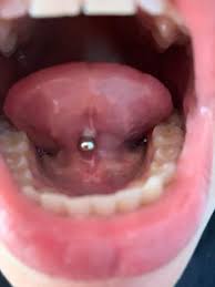 Zungenpiercing Eiter Piercing