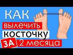 можно ли избавиться от косточки на ноге без операции Pin Na Doske Zdorov Ya