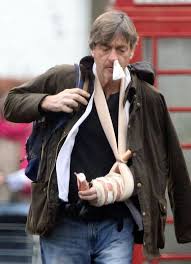 Richard madeley and judy finnigan complain to police over trolls' threats. Richard Madeley Looks Beaten Up After Shattering His Elbow Never Known Pain Like It Daily Record