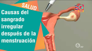 Causas Del Sangrado Irregular Despues De La Menstruacion Salud Youtube