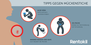 Warum Stechen Mucken Was Hilft Bei Muckenstichen